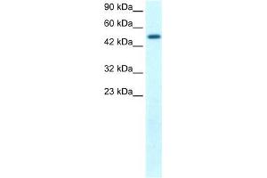 Human Kidney; WB Suggested Anti-FLJ14768 Antibody Titration: 1. (FIZ1 anticorps  (C-Term))