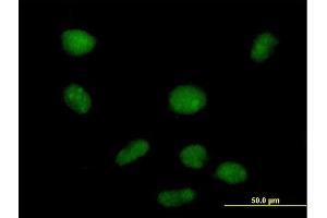 Immunofluorescence of purified MaxPab antibody to PHF19 on HeLa cell.