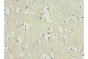 Immunohistochemistry of paraffin-embedded human brain tissue using ABIN7167620 at dilution of 1:100