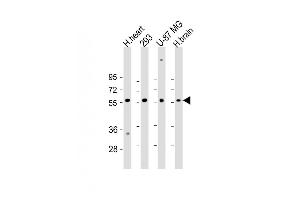 All lanes : Anti-ENTPD2 Antibody (N-term) at 1:2000 dilution Lane 1: H.