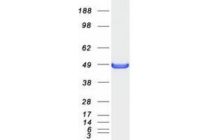 Validation with Western Blot