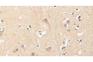 Immunohistochemistry of paraffin-embedded Human brain tissue using RRAD Polyclonal Antibody at dilution 1:50 (RRAD anticorps)