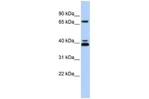 WB Suggested Anti-GATA6 Antibody Titration: 0. (GATA6 anticorps  (Middle Region))