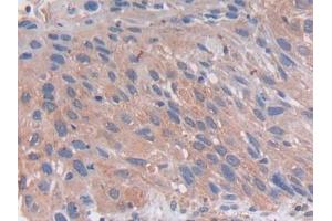 DAB staining on IHC-P; Samples: Human Lung Tissue (PCSK5 anticorps  (AA 115-454))