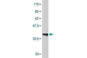 Western Blot detection against Immunogen (36. (GATA3 anticorps  (AA 103-200))