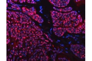 IF analysis of SNRPD2 using anti-SNRPD2 antibody (ABIN7598963). (SNRPD2 anticorps  (AA 1-118))