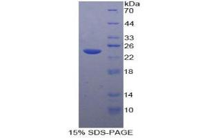SDS-PAGE (SDS) image for Tachykinin Receptor 2 (TACR2) (AA 92-290) protein (His tag) (ABIN1878534)