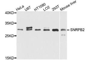 Western blot analysis of extracts of various cell lines, using SNRPB2 antibody (ABIN5995782) at 1/1000 dilution. (SNRPB2 anticorps)