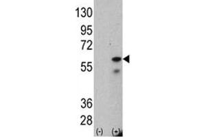 Western blot analysis of PINK1 antibody and 293 cell lysate (2 ug/lane) either nontransfected (Lane 1) or transiently transfected with the human gene.