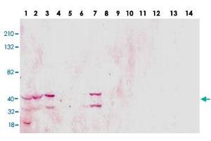 Western blot analysis of TSPY1 monoclonal antibody  in 14 different human cell lines.