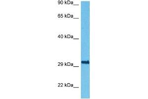 Host:  Rabbit  Target Name:  RCAN1  Sample Tissue:  Human HepG2 Whole Cell  Antibody Dilution:  1ug/ml (RCAN1 anticorps  (Middle Region))