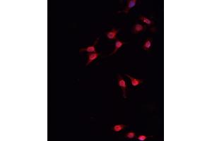 ABIN6266454 staining MCF-7  cells by IF/ICC. (Retinoblastoma 1 anticorps  (pThr826))