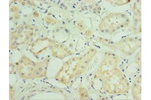 Immunohistochemistry of paraffin-embedded human kidney tissue using ABIN7160003 at dilution of 1:100 (MAPK4 anticorps  (AA 348-587))