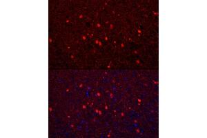 Immunofluorescence analysis of mouse brain using Calretinin Rabbit pAb (ABIN6129247, ABIN6137849, ABIN6137850 and ABIN6225108) at dilution of 1:250 (40x lens). (Calretinin anticorps  (AA 1-271))