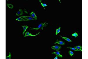 Immunofluorescent analysis of Hela cells using ABIN7149414 at dilution of 1:100 and Alexa Fluor 488-congugated AffiniPure Goat Anti-Rabbit IgG(H+L)