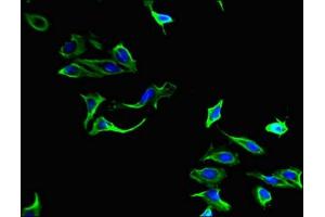 Immunofluorescent analysis of Hela cells using ABIN7149414 at dilution of 1:100 and Alexa Fluor 488-congugated AffiniPure Goat Anti-Rabbit IgG(H+L) (PLA2G4A anticorps  (AA 379-533))