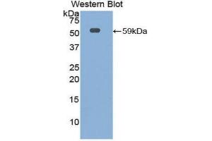 Western Blotting (WB) image for anti-Interleukin 10 Receptor, alpha (IL10RA) (AA 17-241) antibody (ABIN1859329) (IL-10RA anticorps  (AA 17-241))
