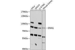 Western blot analysis of extracts of various cell lines, using DN antibody (ABIN6129798, ABIN6139690, ABIN6139691 and ABIN6215711) at 1:1000 dilution. (DNAI1 anticorps  (AA 350-699))