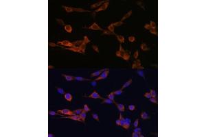 Immunofluorescence analysis of NIH-3T3 cells using YWHAH Polyclonal Antibody (ABIN6131142, ABIN6150348, ABIN6150349 and ABIN6224884) at dilution of 1:100 (40x lens).