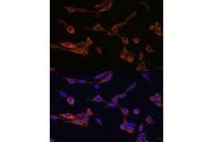 Immunofluorescence analysis of NIH-3T3 cells using YWHAH Polyclonal Antibody (ABIN6131142, ABIN6150348, ABIN6150349 and ABIN6224884) at dilution of 1:100 (40x lens). (14-3-3 eta anticorps  (AA 1-246))