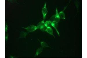 Immunofluorescent staining of LNCaP cells 1