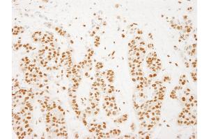 Immunohistochemistry (IHC) image for anti-RD RNA Binding Protein (RDBP) (AA 330-380) antibody (ABIN7448688)