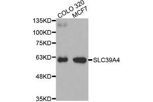 Western Blotting (WB) image for anti-Solute Carrier Family 39 (Zinc Transporter), Member 4 (SLC39A4) antibody (ABIN1874832) (SLC39A4 anticorps)