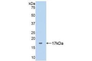 Detection of Recombinant ANXA5, Human using Polyclonal Antibody to Complement 1 Inhibitor (C1INH)
