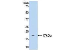 Detection of Recombinant ANXA5, Human using Polyclonal Antibody to Complement 1 Inhibitor (C1INH) (SERPING1 anticorps  (AA 399-500))