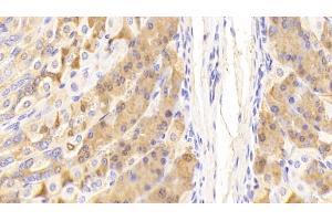 Detection of PGC in Mouse Stomach Tissue using Polyclonal Antibody to Pepsinogen C (PGC) (PGC anticorps  (AA 17-392))