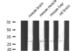 Western blot analysis of extracts of various tissue sample,using MYF5 Antibody .