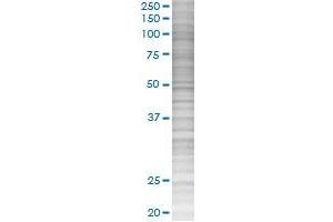 SERPINC1 transfected lysate. (SERPINC1 293T Cell Transient Overexpression Lysate(Denatured))