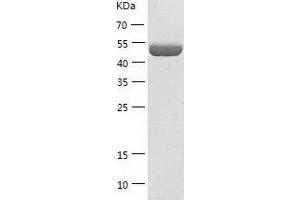 Western Blotting (WB) image for Cytochrome P450, Family 2, Subfamily E, Polypeptide 1 (CYP2E1) (AA 245-493) protein (His-IF2DI Tag) (ABIN7122582)