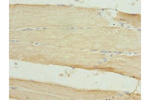 Immunohistochemistry of paraffin-embedded human skeletal muscle tissue using ABIN7150730 at dilution of 1:100