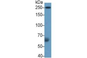Rabbit Detection antibody from the kit in WB with Positive Control: Sample Human serum.