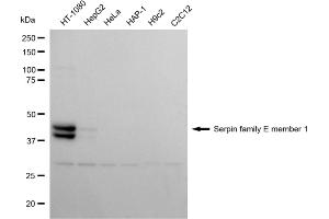 Western blotting analysis using serpin family E member 1 antibody (ABIN7799845). (Recombinant PAI1 anticorps)
