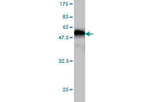 Western Blot detection against Immunogen (45. (PRKRIP1 anticorps  (AA 1-184))
