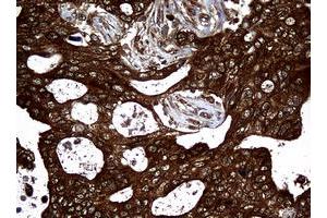 Image no. 5 for anti-Non-Metastatic Cells 1, Protein (NM23A) Expressed in (NME1) antibody (ABIN1499754)