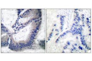 Immunohistochemistry (IHC) image for anti-Nitric Oxide Synthase 2, Inducible (NOS2) (C-Term) antibody (ABIN1848648) (NOS2 anticorps  (C-Term))