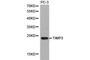 Western Blotting (WB) image for anti-TIMP Metallopeptidase Inhibitor 3 (TIMP3) antibody (ABIN1875099) (TIMP3 anticorps)