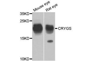 Western blot analysis of extracts of various cell lines, using CRYGS antibody. (CRYGS anticorps  (AA 1-178))