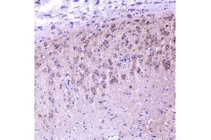 IHC analysis of cortactin using anti-cortactin antibody (ABIN6719306). (Cortactin anticorps  (AA 1-105))