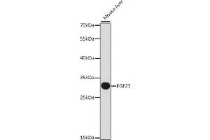 Western blot analysis of extracts of mouse liver, using FGF23 antibody (ABIN6133696, ABIN6140599, ABIN6140601 and ABIN6218305) at 1:1000 dilution. (FGF23 anticorps  (AA 100-200))