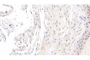 Detection of ROS1 in Human Placenta Tissue using Monoclonal Antibody to C-Ros Oncogene 1, Receptor Tyrosine Kinase (ROS1)