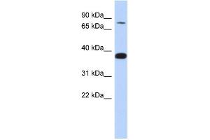 WB Suggested Anti-ZNF526 Antibody Titration:  0. (ZNF526 anticorps  (N-Term))