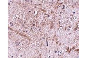 Immunohistochemistry (IHC) image for anti-Translocase of Outer Mitochondrial Membrane 70 (TOMM70A) (N-Term) antibody (ABIN1031635) (TOM70 anticorps  (N-Term))