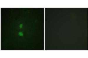 Immunofluorescence analysis of HuvEc cells, using SNAI1 (Phospho-Ser246) antibody. (SNAIL anticorps  (pSer246))