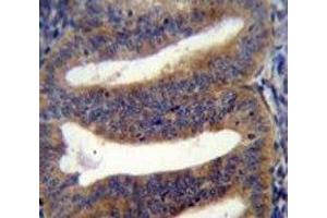 anti-RNA Binding Protein with Multiple Splicing 2 (RBPMS2) (AA 113-141) antibody