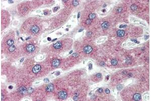 Human Liver (formalin-fixed, paraffin-embedded) stained with PTHR1 antibody ABIN334275 at 5 ug/ml followed by biotinylated anti-mouse IgG secondary antibody ABIN481714, alkaline phosphatase-streptavidin and chromogen.