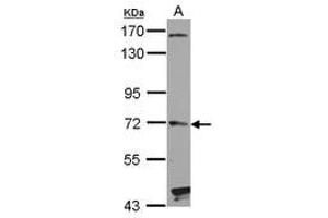 Image no. 1 for anti-Hedgehog Interacting Protein (HHIP) (AA 386-635) antibody (ABIN1498651) (HHIP anticorps  (AA 386-635))